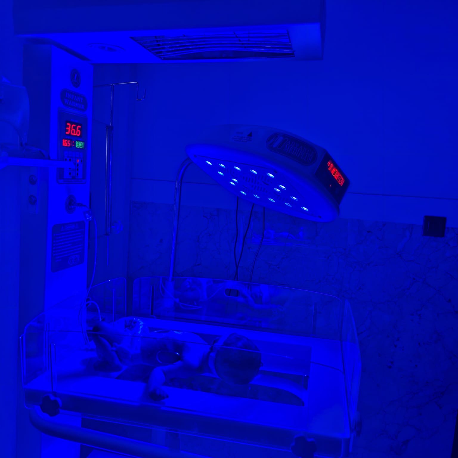 Phototherapy unit for newborns at Shivam Hospital